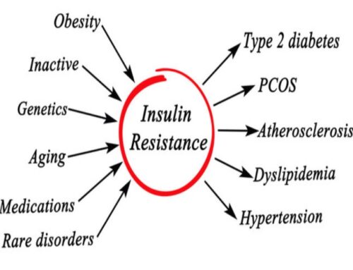 Are You Insulin Resistant?